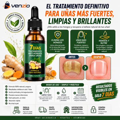 🔥 ¡BASTA DE ESCONDER TUS UÑAS! ⚡ TRATAMIENTO ANTI HONGOS 7 DÍAS 100% NATURAL